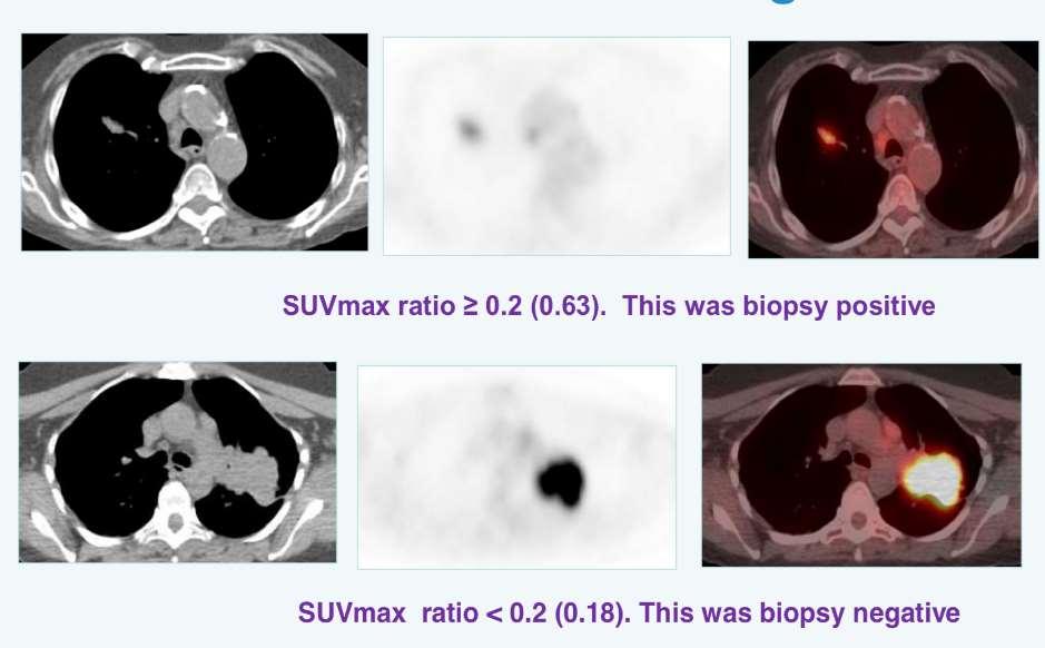 Ο ρόλος της PET/CT