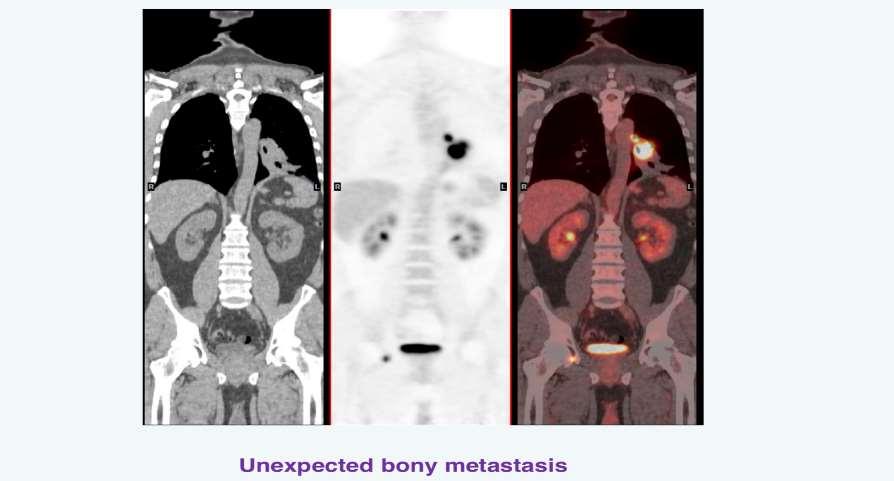 Ο ρόλος της PET/CT