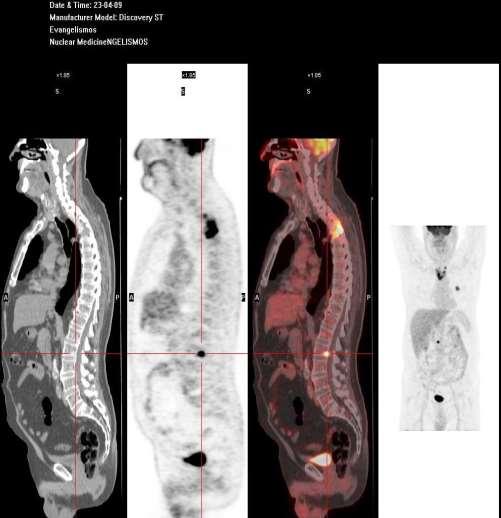 PET/CT