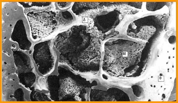 Δικτυωτό (Δοκιδώδες ή Σπογγώδες) οστό (Δ), που περιέχει το μυελό των οστών