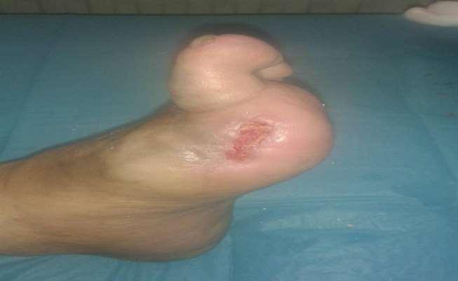 Κόκκινο και ρόζ χρώμα