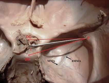 (Saxena et al.