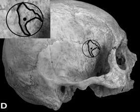 sphenoid articulates with