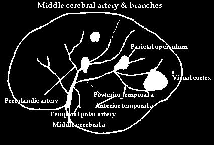 cerebral