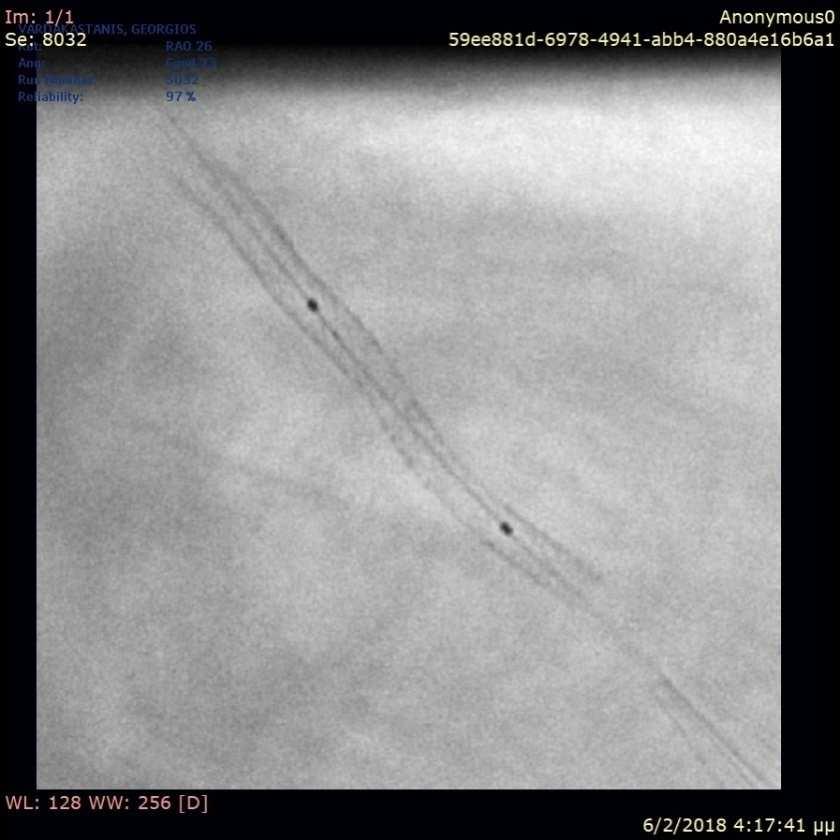 C/ANG-2
