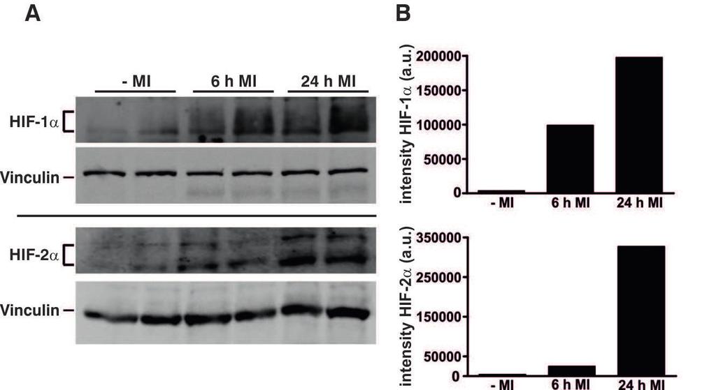 www.karger.com/cpb 848 response and the functional outcome after myocardial infarction. Gain of PHD3 restrained detectable indicating that altered HIF 5E).