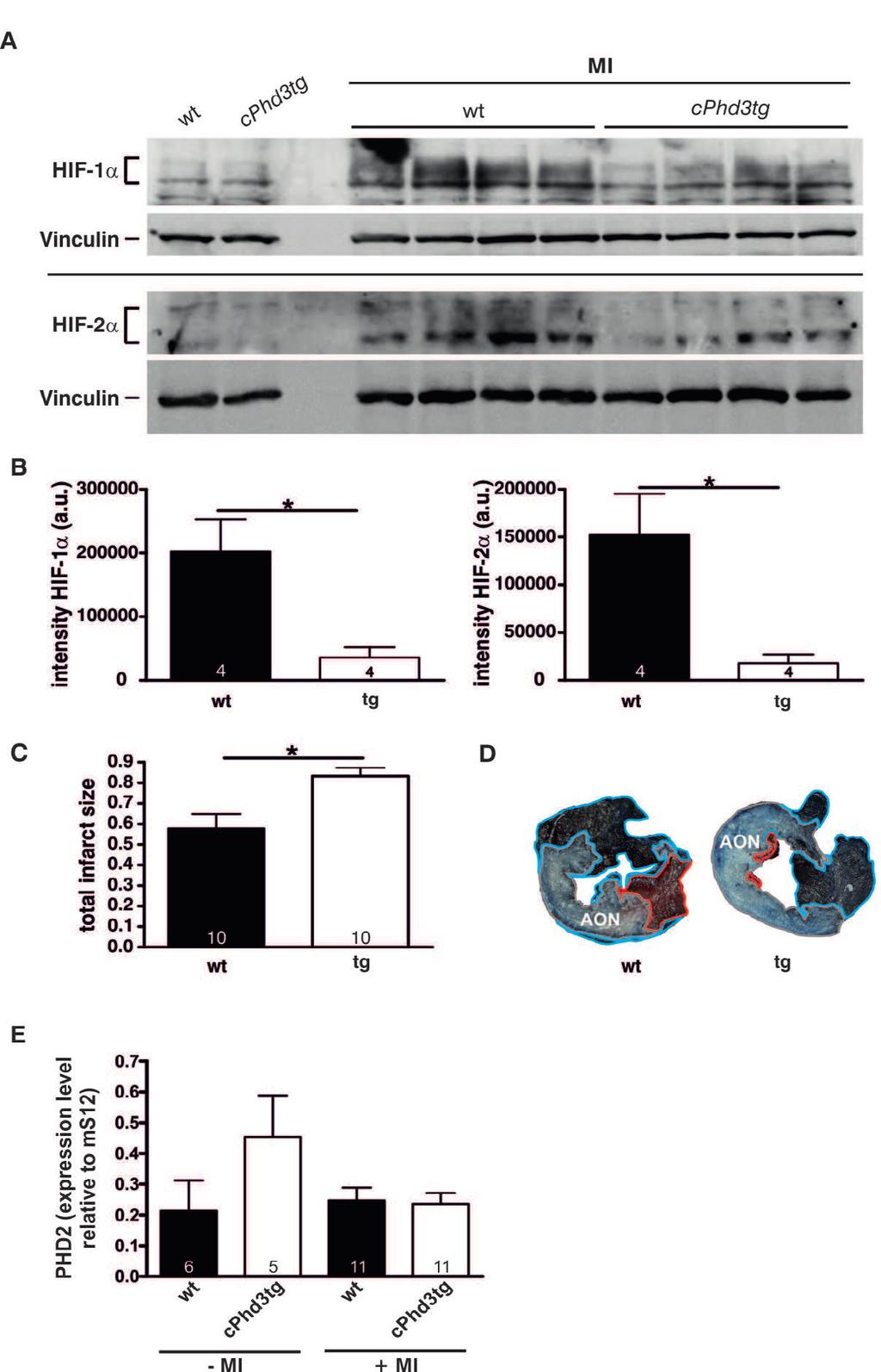 www.karger.com/cpb 849 Fig. 5. PHD3 overexpres- sponse and outcome after myocardial infarction. cphd3tg LAD ligation. 6 hours after ern blots (A) and quanti- protein loading control.