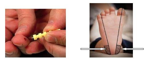 - Preporuča se uzimanje krvi iz prstenjaka lijeve ruke (ljevacima iz desne), djeci iz srednjeg prsta, a dojenčadi iz pete (lateralni dijelovi).