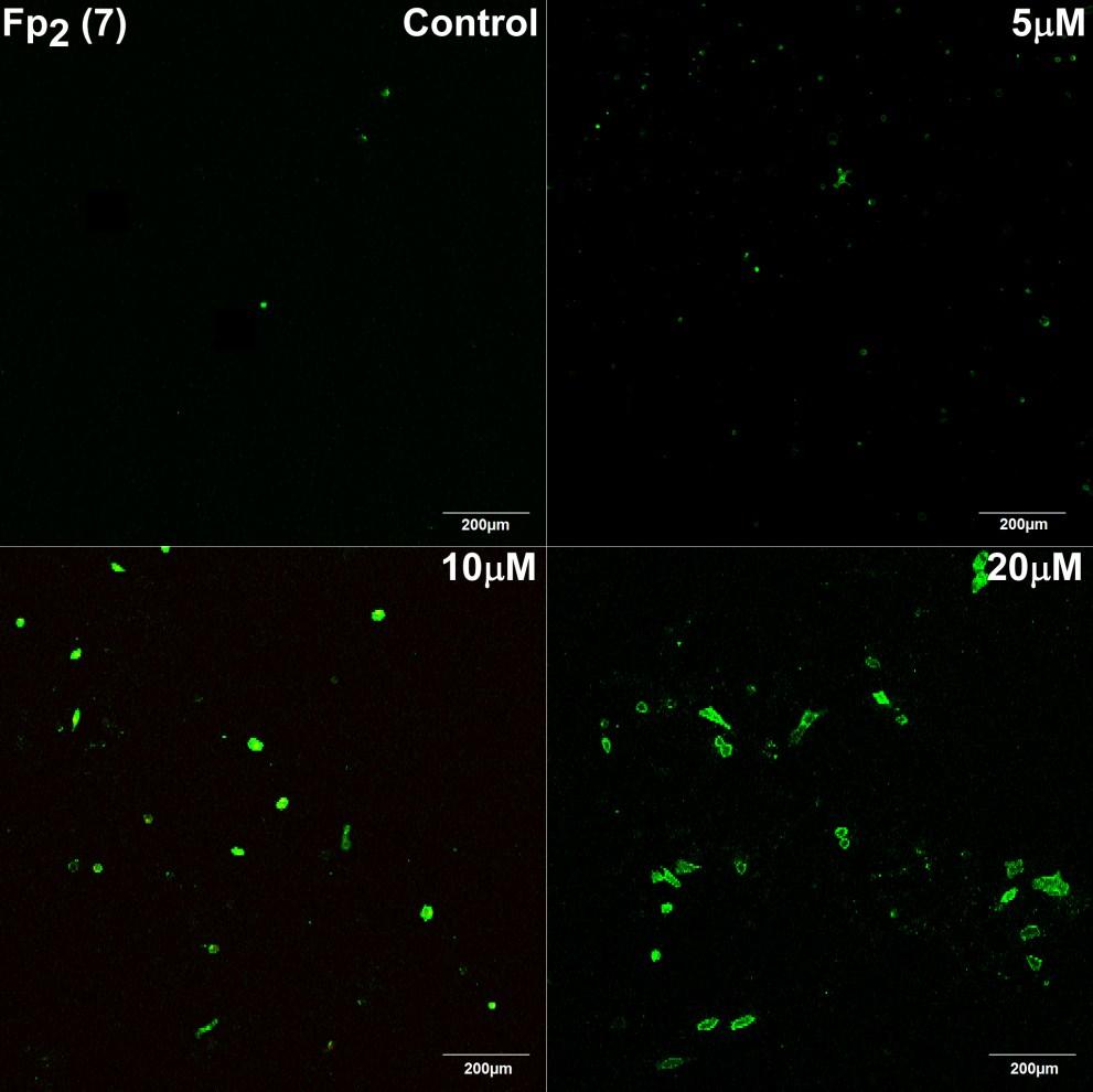 Annexin V (green) and PI (red) stained MDA-MB-231 cells after treatment