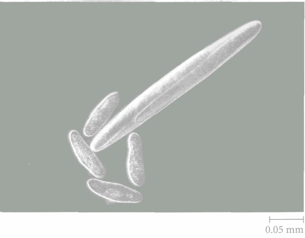 G. Niac: Mediul biotic. Note de curs. Procariotes. Protista 49 Fig. 7.5. Cea mai mare celulă procariotă: Epulopiscium fishelsoni de aproape un jumătate de mm şi cu Φ de cca.