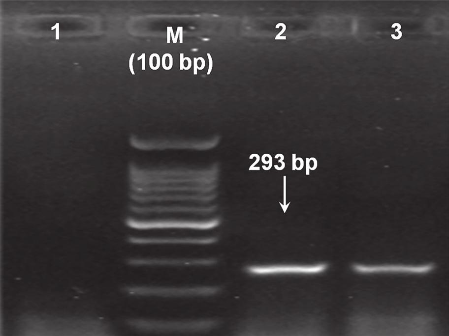 1395 1 شماره 71 دوره دامپزشکی تحقیقات مجله 86 DNA تکثیر از حاصل PCR محصول به متعلق آگارز ژل الکتروفورز 1.