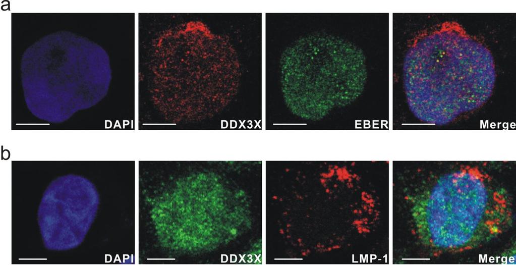 Supplementary Figure 6 Cellular localizations of DDX3X and EBV-associated RNA or protein in EBV-infected natural killer cell line KAI3.