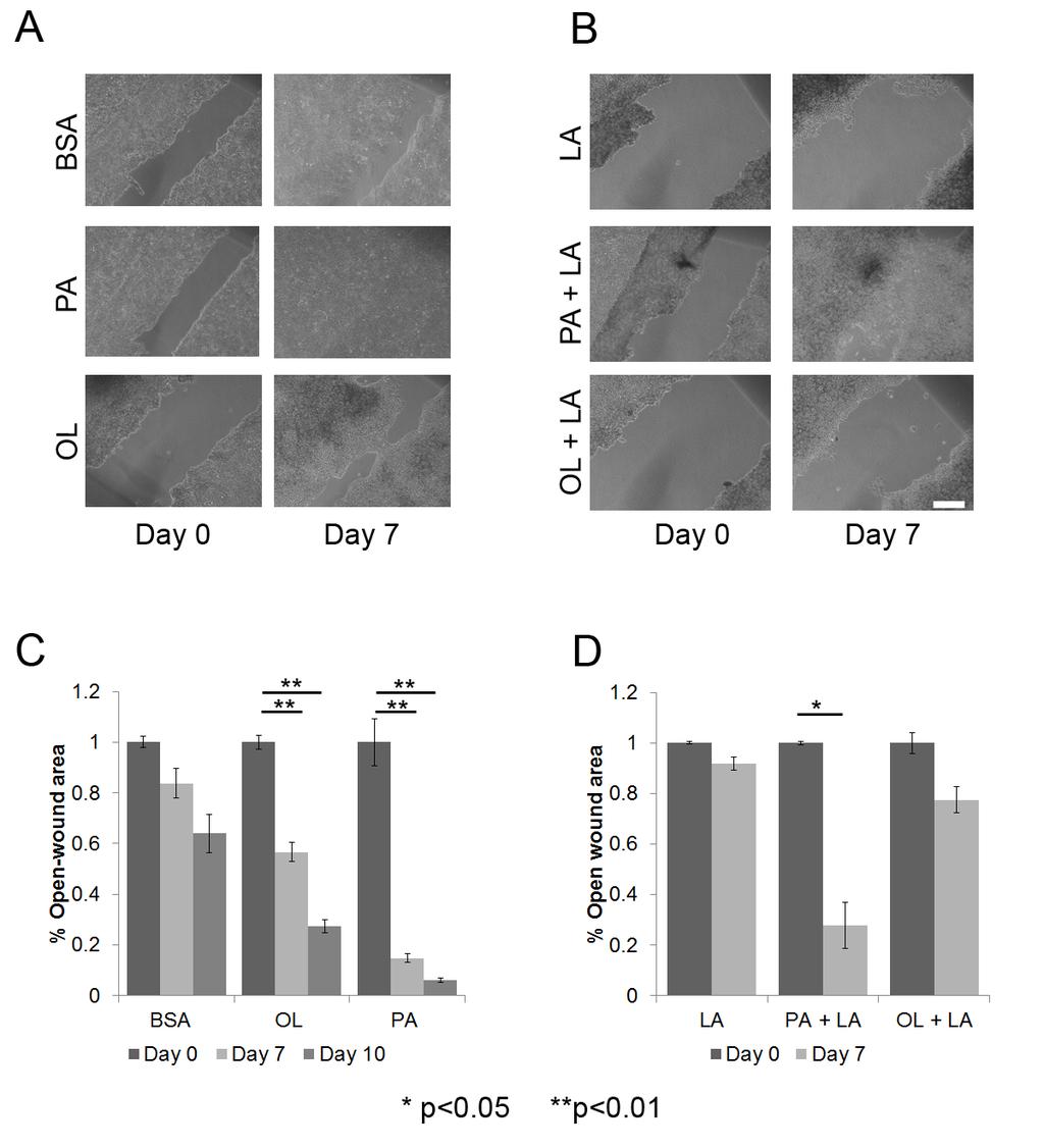 Supplementary Figure 1: Differential effects of FFAs on migration. A & B. Scratch-wound healing assays.