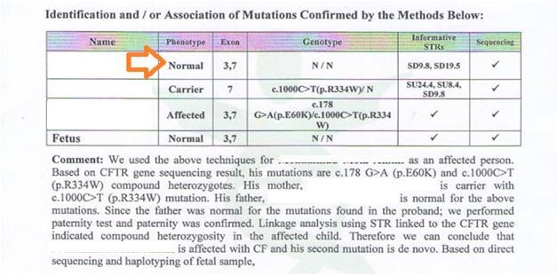 5-35 Normal Borderline:35-60 CF:60-200 Sweat Test Result for a 2 month