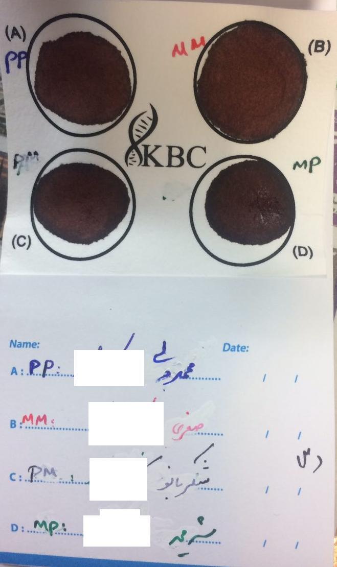 کارت DBC