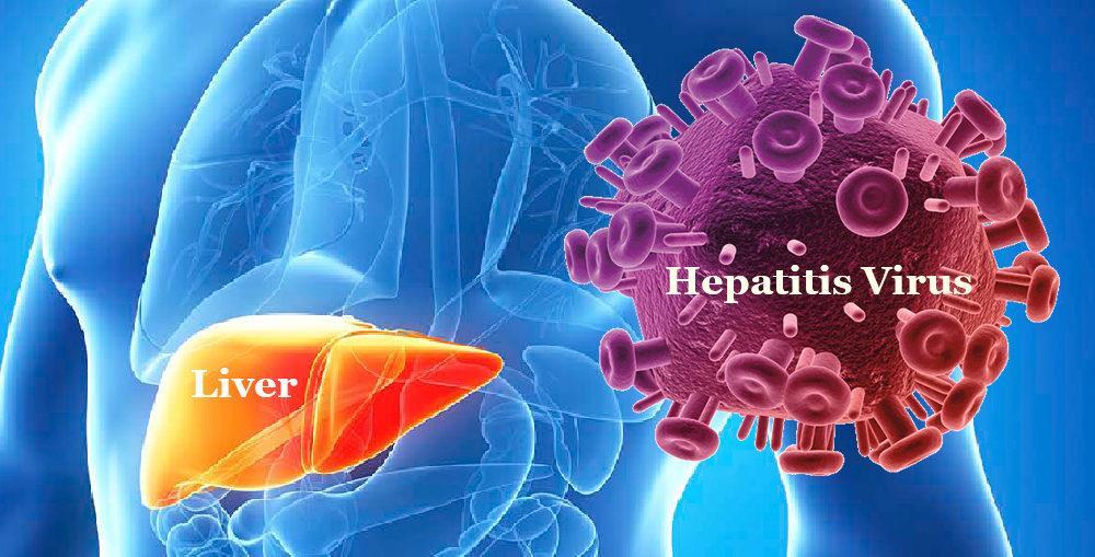 Hepatitis zapaljenje/upala jetrenog parehima Etiologija Infektivna Virusi
