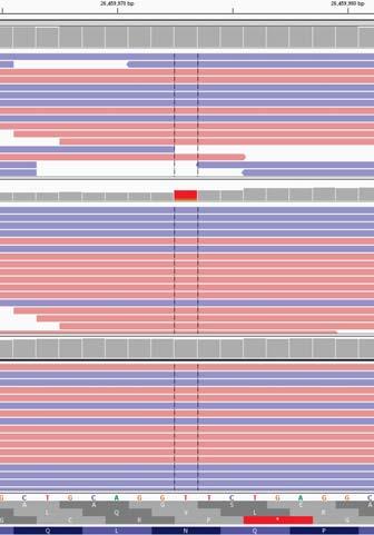 Notch1 Sanger Sequencing 46 PEST DOMAIN ALL11 (wildtype)