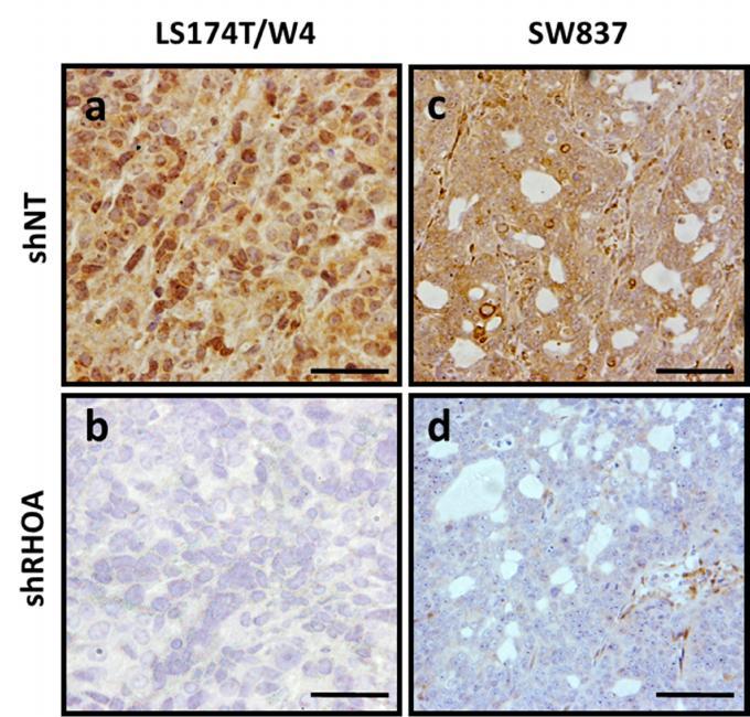 RHOA and colorectal cancer Paulo Rodrigues et al 2014 Supplementary Figure 5: Stable shrna-mediated knockdown of RHOA on colon cancer cells and confirmation of the specificity of the anti-rhoa