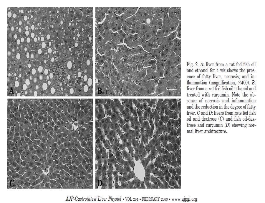 Curcumin prevents alcohol-induced liver disease in rats by inhibiting the expression of NF-B-dependent genes Fish Oil & Ethanol Fish Oil & Ethanol &