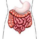 htm 56 IBS IBS Irritable Bowel Syndrome אחוז האוכלוסייה שסובלים מתסמונת המעי הרגיז הוא בין 5 ל- 45% כאשר במדינות מערביות מעל 10% מהאוכלוסייה