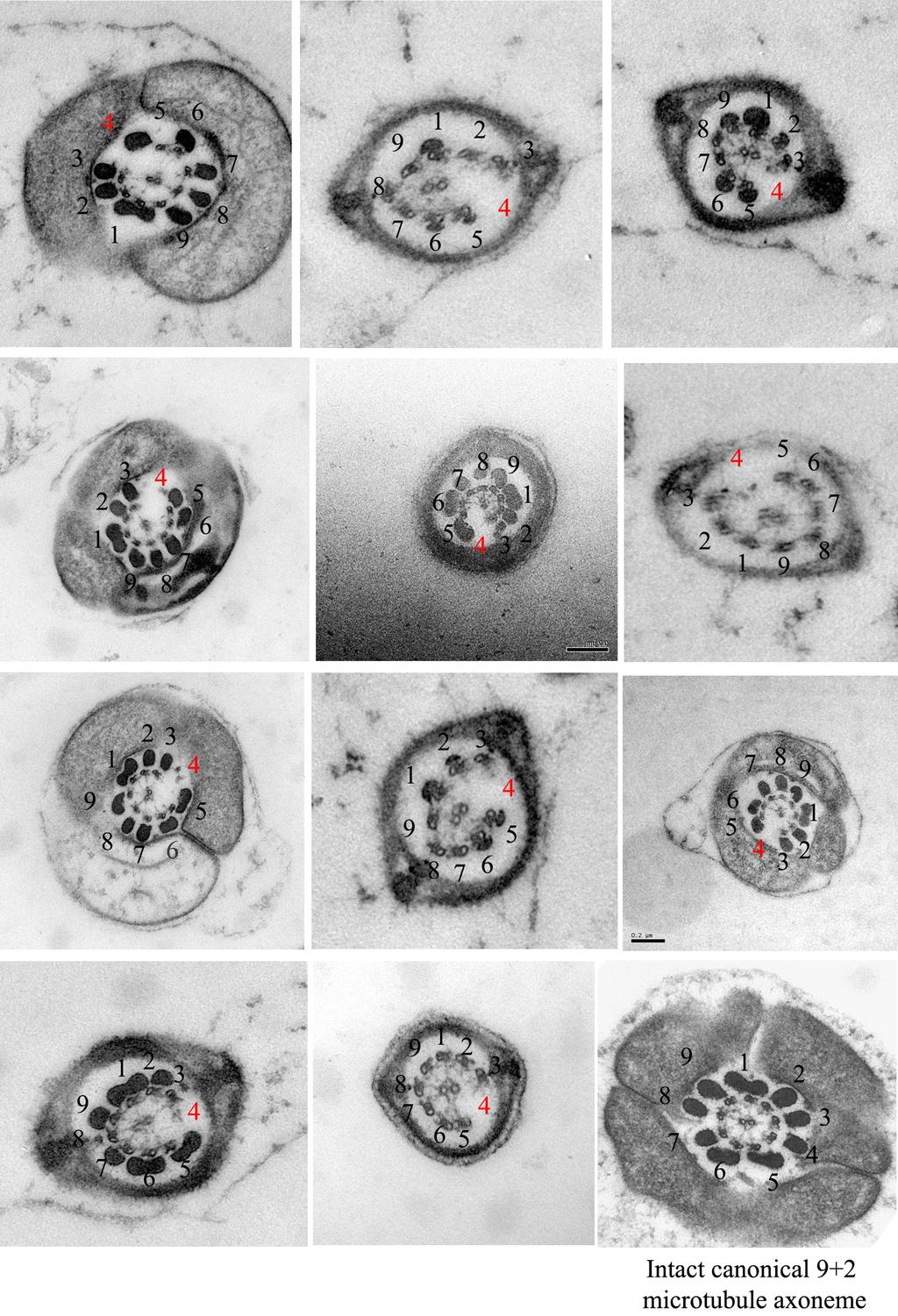 Supplementary Material for Lee et al., Page 16 Fig. S2: Assignment of missing doublet in axonema of Stamptm/tm mice.