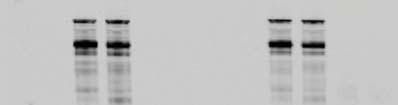 Figure 8 A Donor 1 Donor 2 SDS: + + + + DIFP: + + + + MLi-2: - + -