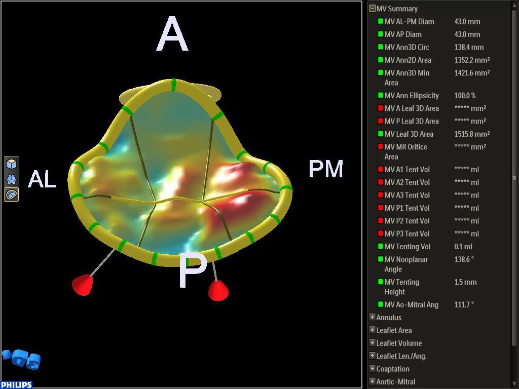 Mitral