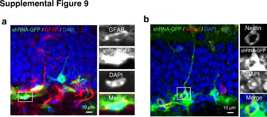 Supplemental Fig. 8. The β-catenin shrna-gfp+ and control-gfp+ cells co-localized with Sox2.