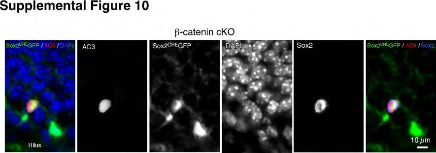 Supplemental Fig. 10. Immunohistochemical analysis of apoptotic cells labeled by active caspase 3 in β-catenin cko mice.