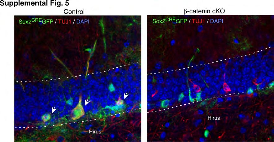 Supplemental Figure 5. Immunohistochemical analysis of the TUJ1+ cells in β-catenin cko mice.