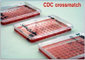 Ανίχνευση αντισωμάτων με CDC και Flow Cytometry (CM) Χαμηλή ευαισθησία και ειδικότητα Μη διαχωρισμός μεταξύ IgG και IgM (μόνο εμμέσως με DTT) Ψευδώς θετικά αποτελέσματα λόγω ανίχνευσης non-hla