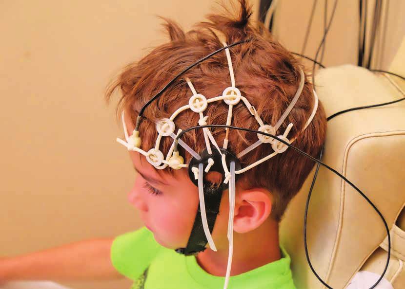 vyšetrením je elektroencefalografia (EEG), ktorá zaznamená patologické bioelektrické vlny mozgu. Ale ani tu nemusí byť preukázateľný nález.