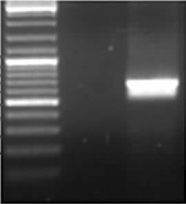 recombinant plasmids Lanes 1~5: PCR products of PMD 18-T-Sumf 1-M 1 plasmids Lanes 6~10: PCR products of PMD 18-T-Sumf 1-M 2 plasmids Lanes 11~12: PCR products of PMD 18-T-Sumf 1-M entire plasmids 22