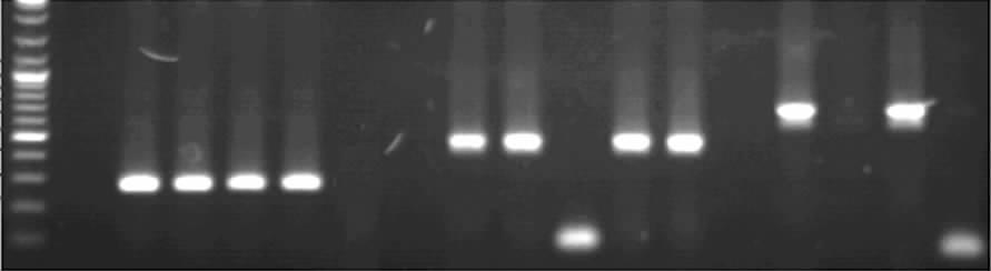 5 : PCR Sumf1 435 Marker 1 2 3 4 5 6 7 8 9 10 11 12 13 14 6 ptal-sumf 1-M 1 ptal-sumf 1-M 2 ptal-sumf 1-M PCR 1~4 6 7 9 10 11 13 PCR ; 5 8 12 14 1~4 ptal-sumf 1-M 1 PCR ; 6 7 9 10 ptal-sumf 1-M 2 PCR