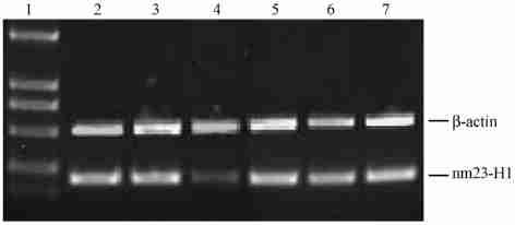 10 L,, BIO2RAD 550 detected by RT2PCR 570nm A ( 630nm) 1 : DL2000 markers ; 2 : transfected with sinm80 ; 3 : transfected with sinm497 ; 4 : transfected with sinm526 ; 5 : transfected with Negative :