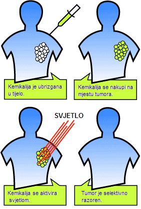 laserskim izvorima stoje upozorenja o