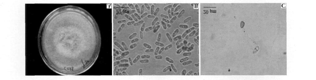 5 : DNA2ITS 745 11514 PCR PCR 25 L: DNA, 015 mol, 4 dntp 50 mol, 215 L 10 PCR, 2 mmolmg 2 +, 1125 Taq ( Promega), 1, PE2400 PCR: 94 5 m in;, 94 1 m in, 55 30 s, 72 1 m in, 31 ; 72 7 m in UN IQ210