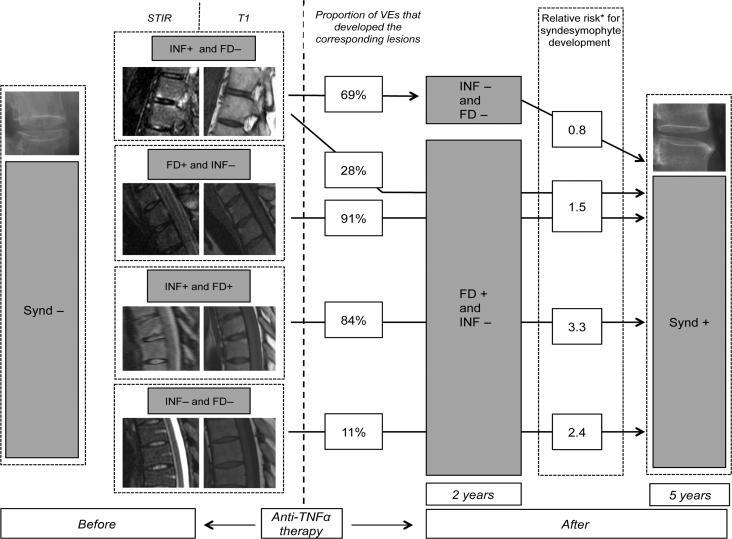 Ποιες βλάβες MRI σχετίζονται με την εμφάνιση