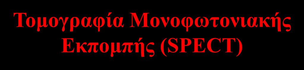 Τομογραφία Μονοφωτονιακής Εκπομπής (SPECT) A B 1963: Οι Kuhl και Edwards ήταν οι