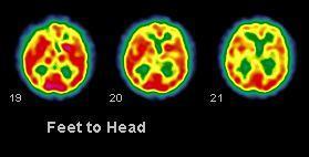 BRAIN
