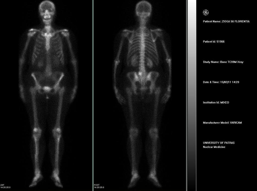 Ολόσωμο Scan