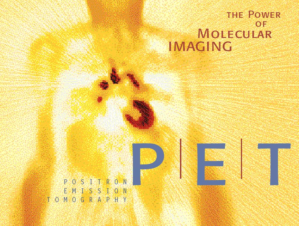 PET