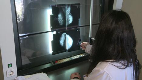 ΠΡΟΓΡΑΜΜΑΤΑ ΠΡΟΛΗΠΤΙΚΗΣ ΙΑΤΡΙΚΗΣ ΠΡΟΛΗΨΗ Ca ΜΑΣΤΟΥ A. Πρόγραμμα Ψηφιακών Μαστογραφιών 3.500 δωρεάν μαστογραφίες σε 49 Δήμους Ο καρκίνος του μαστού είναι ο πιο συνήθης στις γυναίκες σ όλο τον κόσμο.