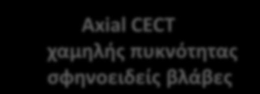νεφρικής πύλης) Axial CECT χαμηλής πυκνότητας σφηνοειδείς
