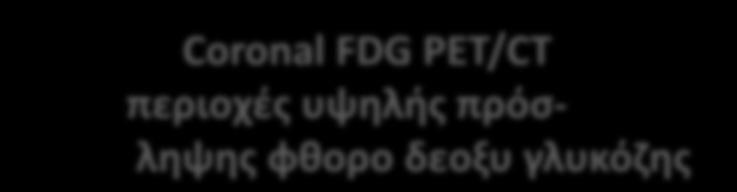 δεοξυ γλυκόζης Tang, C.S.W., Sivarasan, N. & Griffin, N.