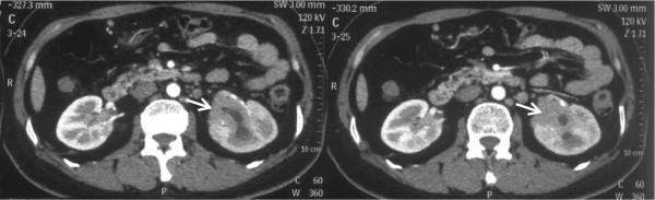 Παρουσίαση περιστατικού CT scan MRI (T2