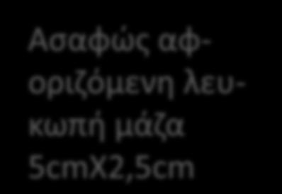 Αριστερή