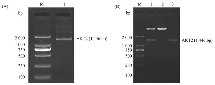 11 AKT2 1047 AKT2 2 2 AKT2 L181 M181 DN- Quikchange WT- Lys AAG Met ATG AKT2 181 Lys 4 pcdna3 1-myc-HisA - 181 Fig 2 Fig 1 RT-PCR amplification of AKT2 cdna and recombinant plasmid identified by Kpn