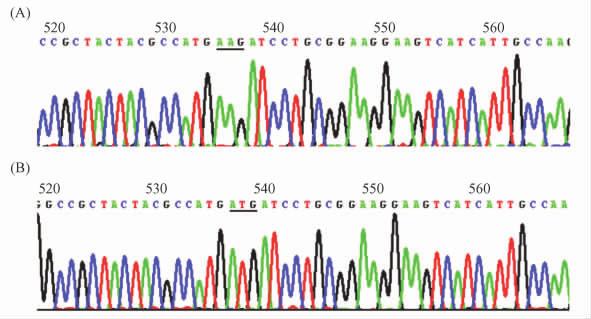 obtained by RT-PCR B M DL2000 DNA marker 1 Recombinant plasmid digested by KpnⅠ + NheⅠ 2 Empty plasmid digested by KpnⅠ + NheⅠ 3 AKT2 cdna obtained by RT-PCR Fig 2 Part inserted sequences of DN-AKT2