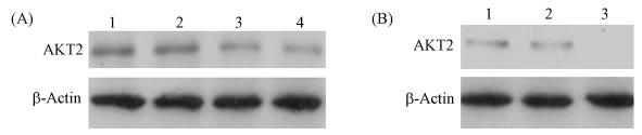 1048 27 Fig 3 AKT2 expression in MCF-7 cells analyzed by Western blotting A Over-expressed AKT2 and DN- AKT2 protein in MCF-7 cells were achieved by transfected WT-AKT2 and DN-AKT2 expression vector